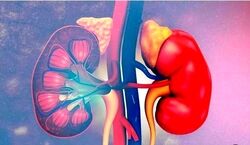 رنگ ادرارتان خبر از بیماریتان می دهد! | با دیدن این نشانه ها به وجود سرطان کلیه مشکوک شوید 