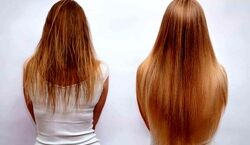 برای بلند شدن سریع موهات از این ترکیب استفاده کن + طرز تهیه 