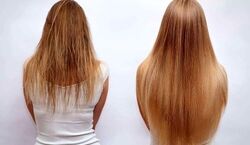 برای بلند شدن سریع موهات از این ترکیب استفاده کن + طرز تهیه 