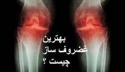 به جای قرص های شیمیایی، غضروف ساز های طبیعی بخورید!