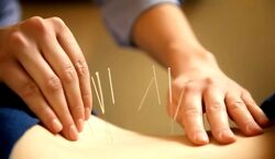 طب سوزنی واقعا درد را کاهش می‌دهد؟ 