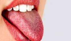 رنگ زبانت رو بگو؛ تا بگم بدنت چه مشکلی داره!!