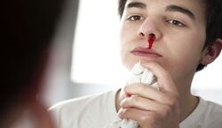 چه زمانی خون دماغ شدن خطرناکه؟ + روش بند آمدن
