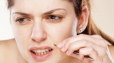 موهای زائد پشت لبت رو با روش های خانگی از بین ببر + فیلم آموزشی