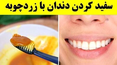 با زردچوبه مسواک بزن! | روش سفید کردن دندان با زردچوبه 
