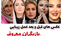 عکس های قبل و بعد عمل زیبایی 7 تا از بازیگران ایرانی | چی بودی چی شدی تو اینجا جوابه!!