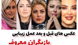 عکس های قبل و بعد عمل زیبایی 7 تا از بازیگران ایرانی | چی بودی چی شدی تو اینجا جوابه!!