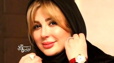 تغییر چهره نیوشا ضیغمی بعد از عمل زیبایی جدیدش شوکه تان می کند! + عکس