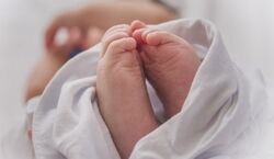 به دنیا آمدن نوزاد 2 سر در قم + عکس
