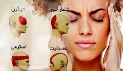 خودت تشخیص بده که چه سردردی داری! | انواع سردرد و درمان آنها