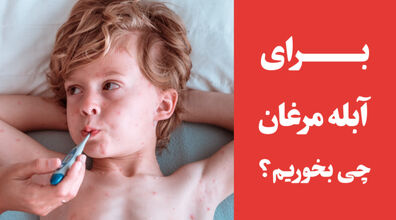 آبله مرغان گرفتم چی بخورم؟ | نوشیدنی ها و خوراکی های مناسب ابله مرغان + ویدیو