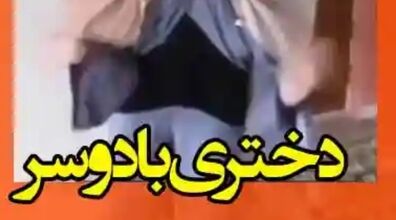  دختر عجیب الخلقه ایرانی که یک سر در ناحیه کمرش دارد + فیلم